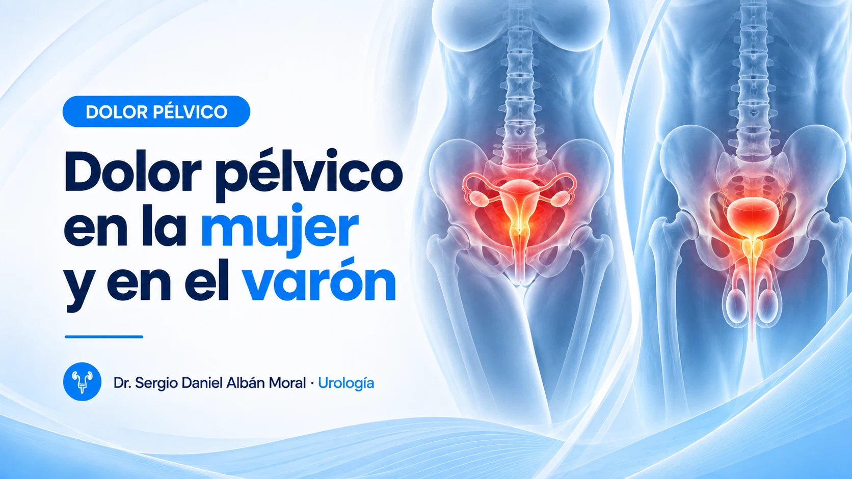 Dolor pélvico en mujeres y hombres